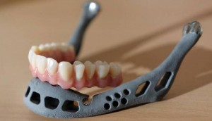 3D Printed Lower Jaw Bone        
