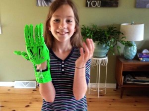3D Printed Prosthetic Hand          